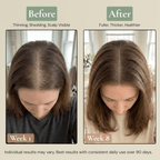 Multi-Peptide Scalp Serum For Hair Growth
