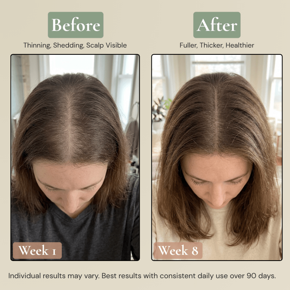 Multi-Peptide Scalp Serum For Hair Growth