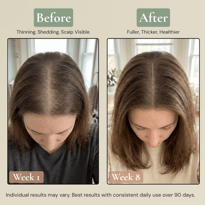 Rhuka All Natural 5-Peptide Hair Growth Elixir