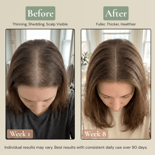 Rhuka All Natural 5-Peptide Hair Growth Elixir