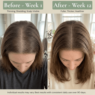 Rhuka Bio Peptide Hair Growth Elixir